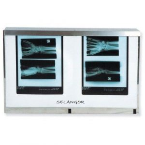 Négatoscope LED – 2 plages