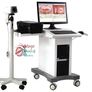 Colposcope vidéo numérique HD de haute qualité sur chariot pour la gynécologie 