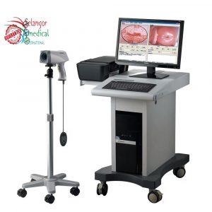 Colposcope vidéo numérique HD de haute qualité sur chariot pour la gynécologie 